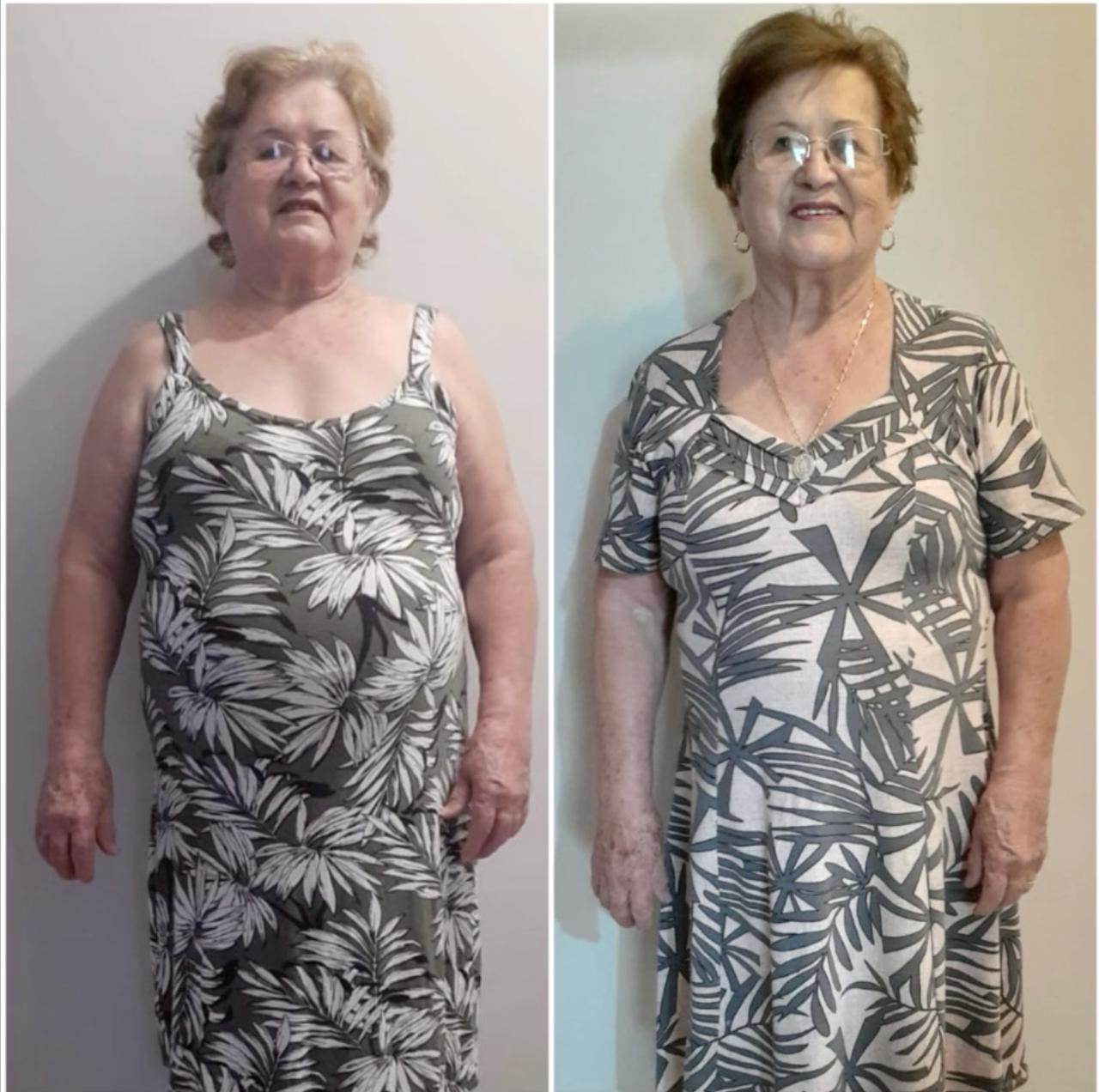 Antes e depois de Nereide