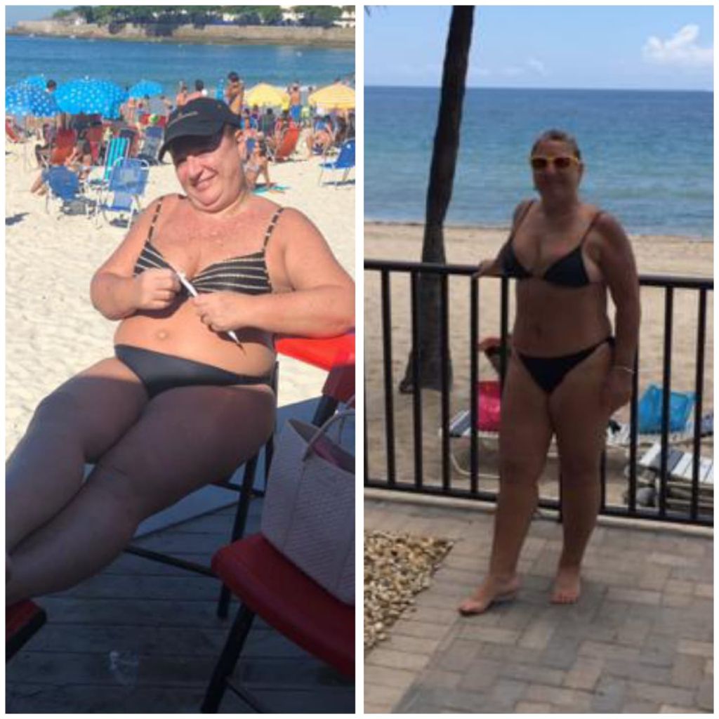 Antes e depois de Rosana