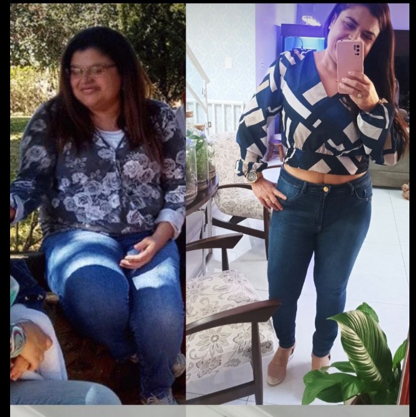 Antes e depois de Andreia Lemos